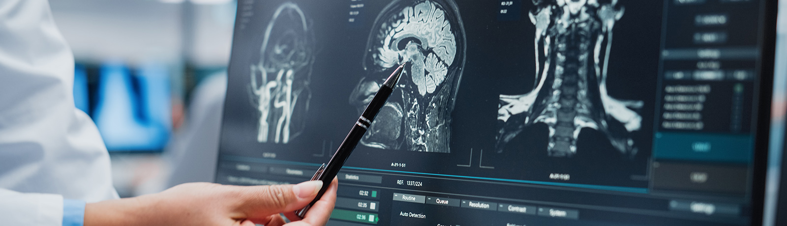 close up of a woman reviewing a brain scan
